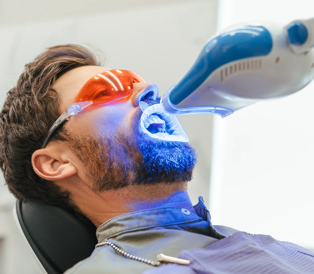 Laser Teeth Whitening